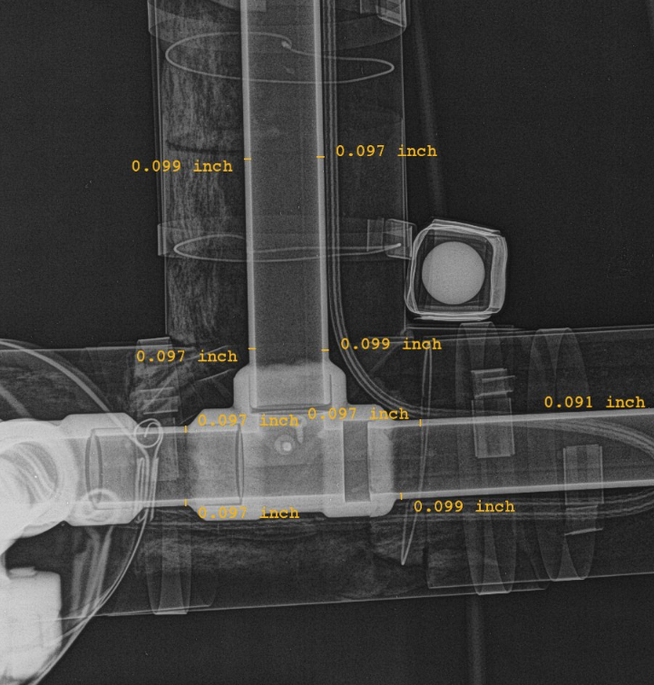Casting radiograph